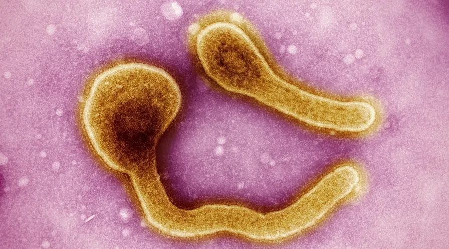 cholera