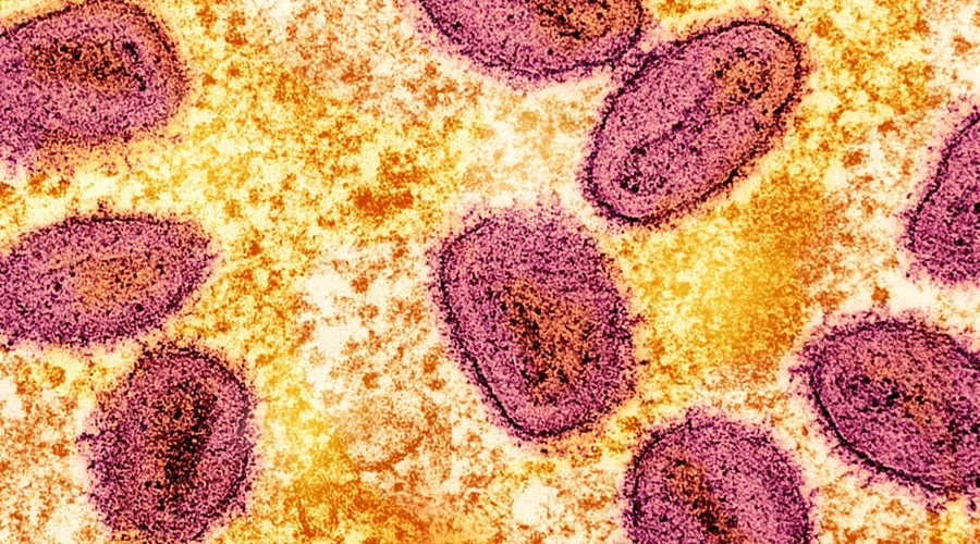 mpox